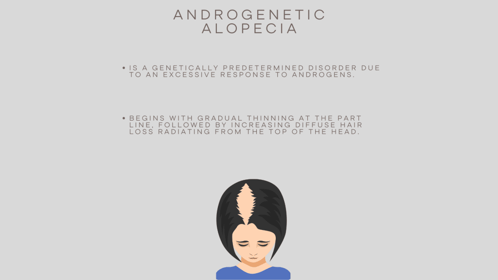 Illustration explaining Androgenetic Alopecia